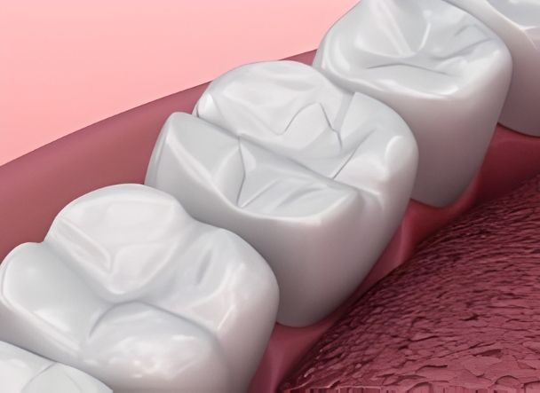 Ilustración 3D de varias muelas blancas en arcada inferior con fisuras en la superficie masticatoria y encía rosada.