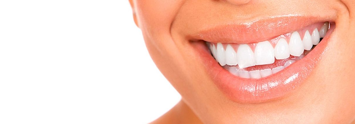 Primer plano de una sonrisa con labios rosados y dientes blancos alineados sobre fondo blanco.